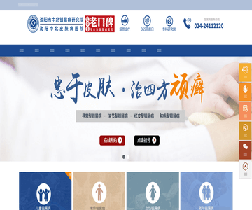 沈阳银屑病医院